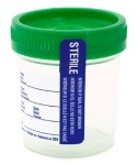 Sterile Urine Cup